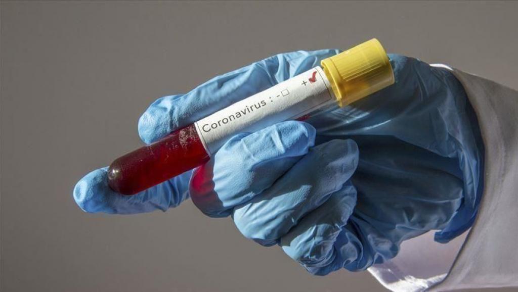 Coronavirus